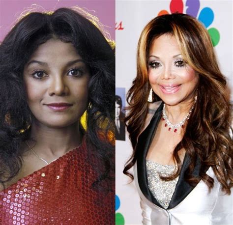 latoya jackson before plastic surgery|Latoya Jackson Plastic Surgery Before and After